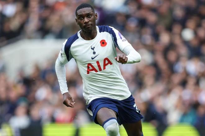 队报：穆阿尼将无需接受手术，休养数周后须佩戴面具比赛